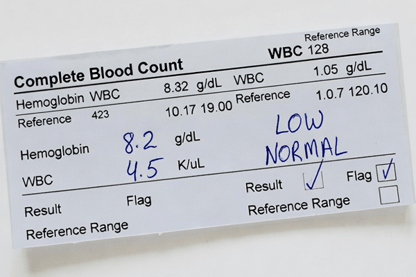 Натуральні товари компанії Vivasan, Швейцарія в категорії Гемоглобін.