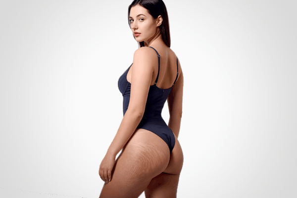 Натуральні товари компанії Vivasan, Швейцарія в категорії Целюліт.