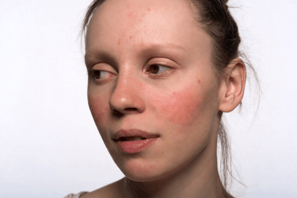 Натуральные товары компании Vivasan, Швейцария в категории Купероз.