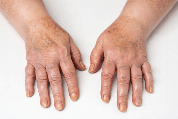 Натуральные товары компании Vivasan, Швейцария в категории Сахарный диабет.